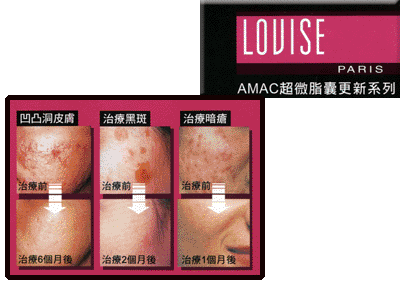 ��������Louise AMAC (��΢֬�Ҹ���)ȥ�ഺ��(����) �����ױ�ʪ��Ԥ��ȸ�ߡ����ϡ�Ƥ�����׵ȵ�